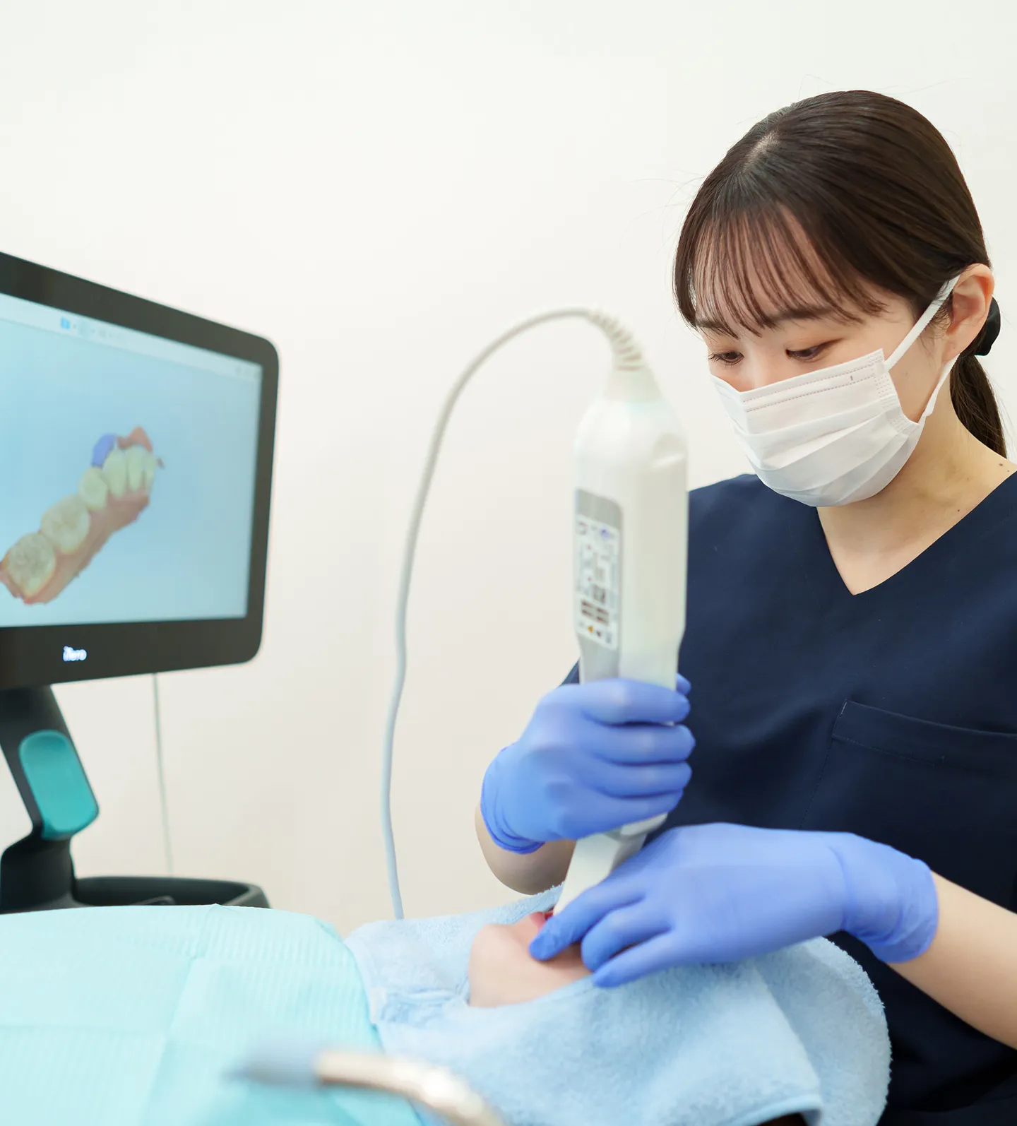 口腔内スキャナーによる手軽な印象採取